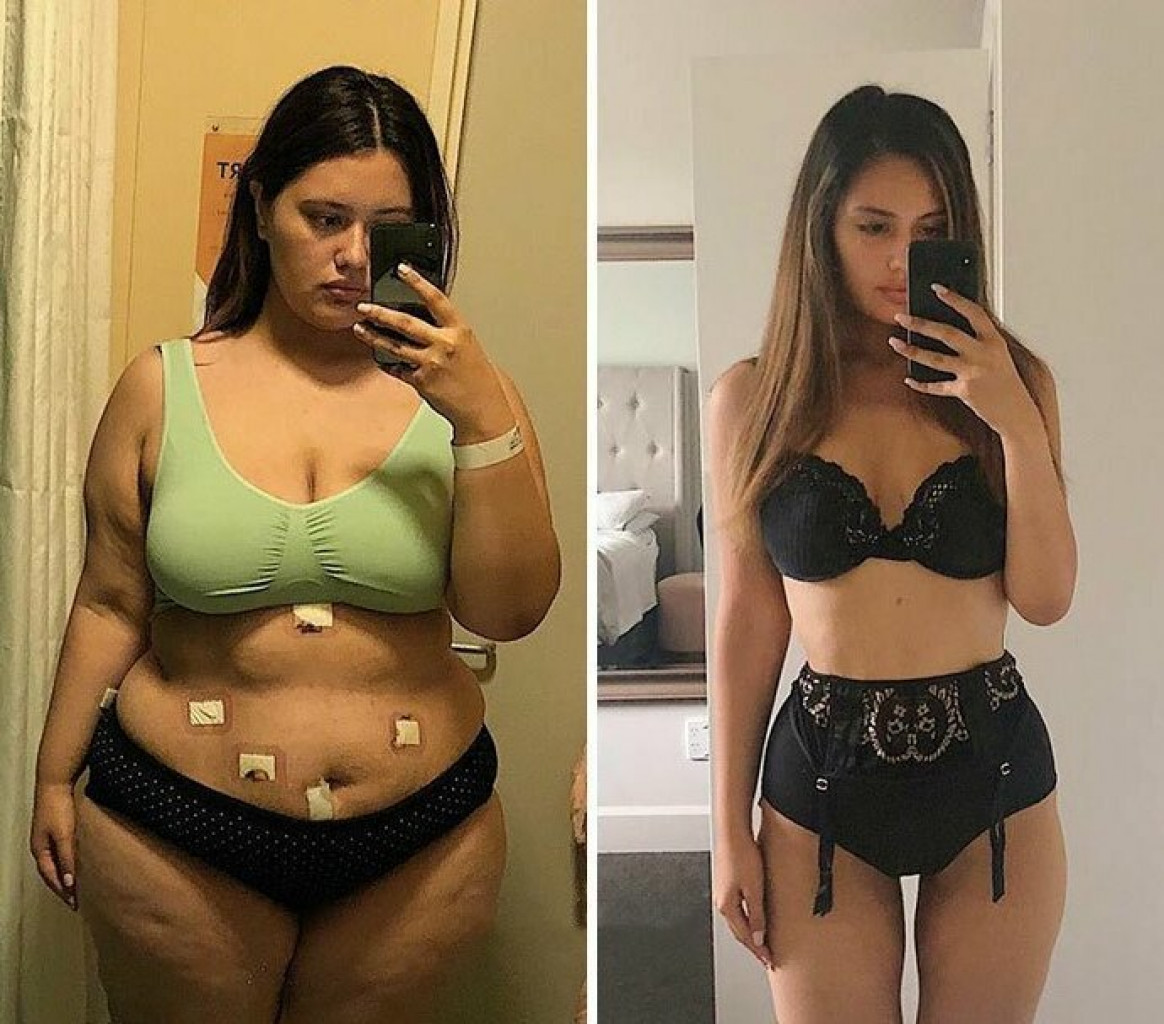 экстремальные похудения фото до и после